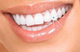 Dentalni kristali Swarovski
